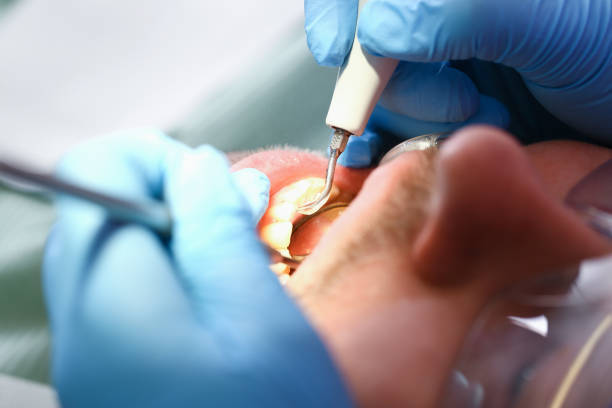 Best Emergency Treatment for Toothache in Forsyth, IL