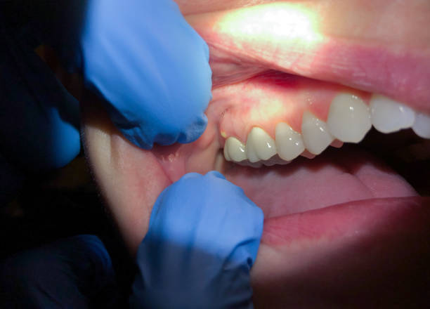 Best Same-Day Emergency Dentist in Forsyth, IL