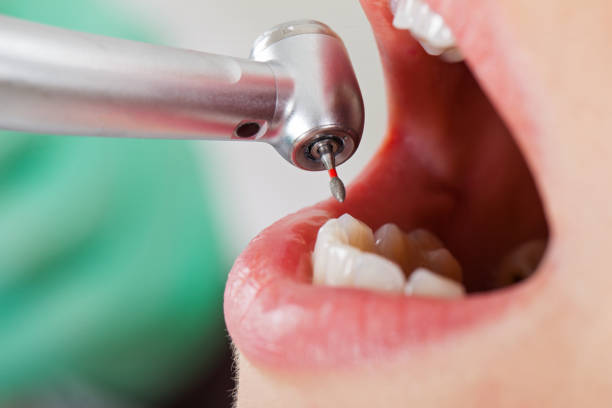 Best After-Hours Emergency Dentist in Forsyth, IL